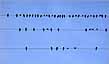 rhythm wire
